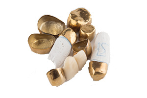 金歯・金入れ歯